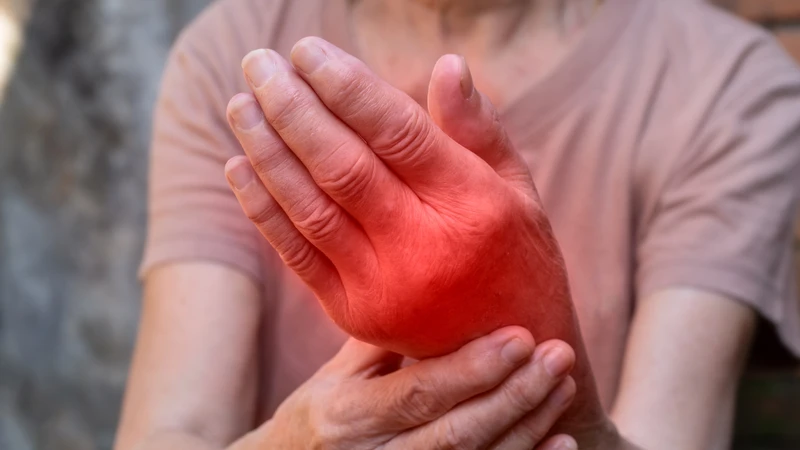 Bệnh nhân sốt xuất huyết bị phù tay chân có sao không? 2