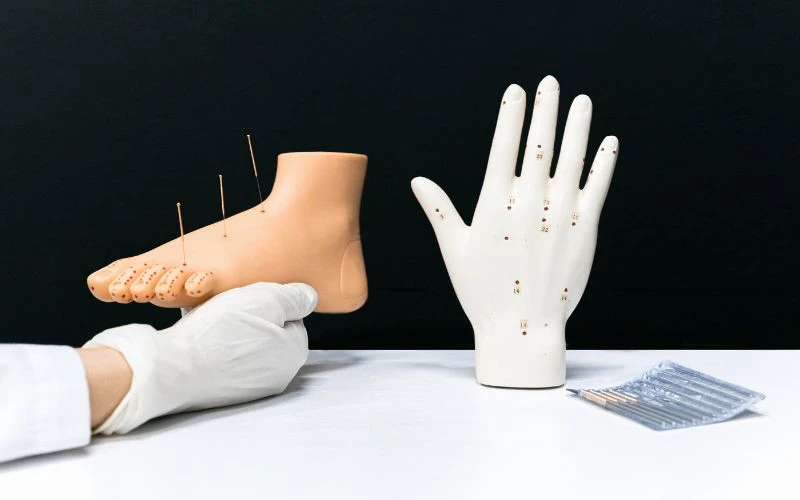 Bác sĩ sẽ lựa chọn huyệt đạo tùy theo từng mục địch để châm cứu