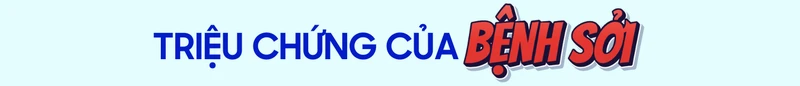 benh-soi (2).png