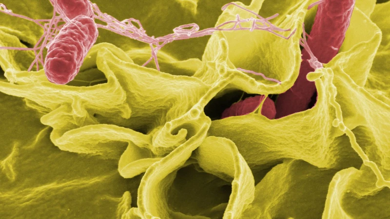 Bacillus anthracis là một&nbsp;trực khuẩn Gram dương gây ra bệnh than