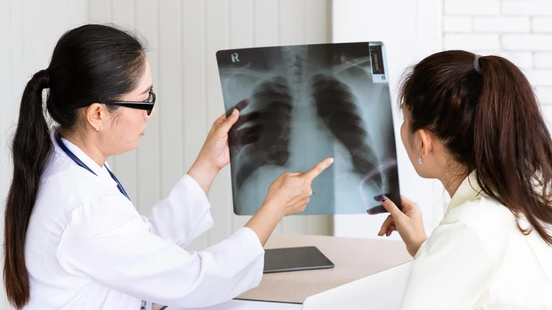 Bệnh ung thư phổi có di truyền không? 4