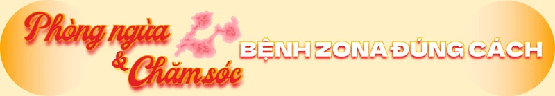 benh-zona-co-lay-khong-va-co-nen-kieng-gio-4.png