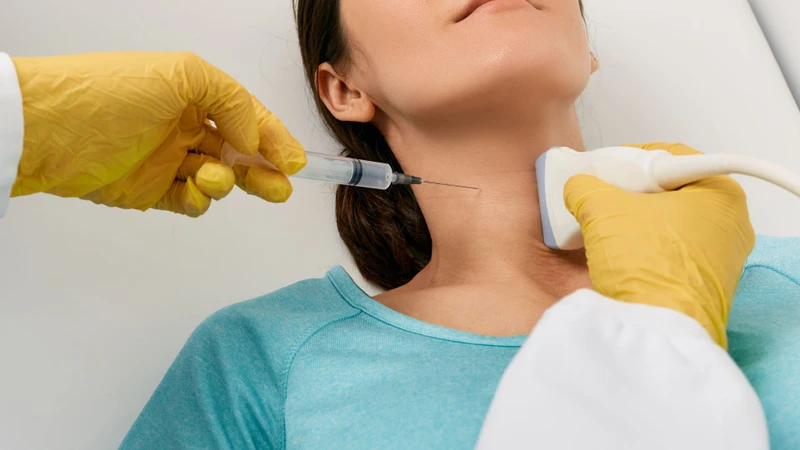 Chọc hút tế bào bằng kim nhỏ (FNA) lại không phải chỉ định thường quy đối với mọi trường hợp Bethesda nhóm 2
