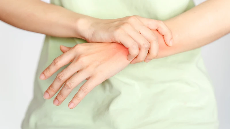 Triệu chứng bong gân cổ tay thường bao gồm đau, sưng, bầm tím và hạn chế vận động