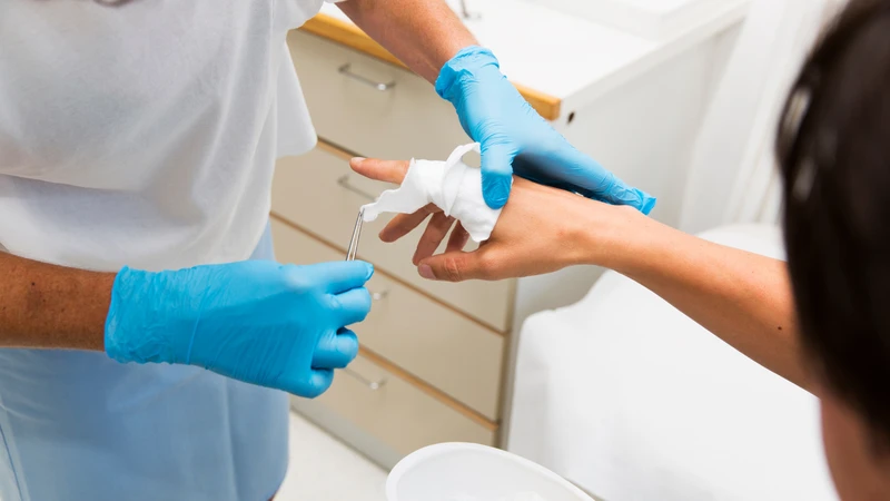 Chăm sóc vết thương đúng cách giúp hạn chế nguy cơ nhiễm trùng khi bị cua kẹp