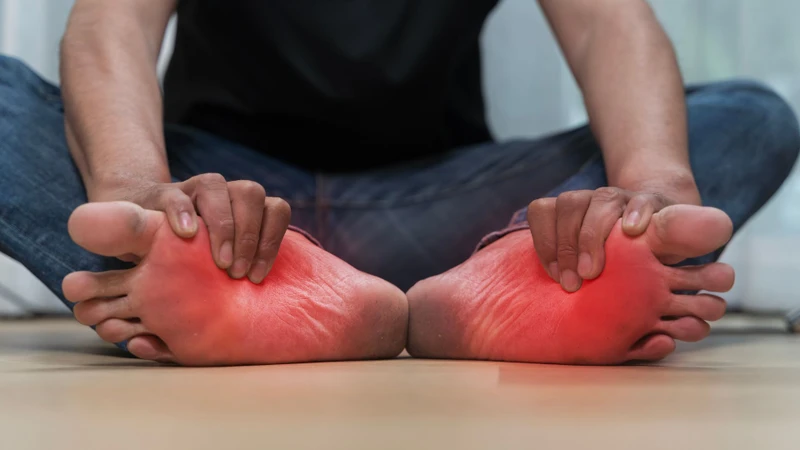 Viêm cân gan chân là một trong những nguyên nhân khiến bạn bị đau nhói ở lòng bàn chân