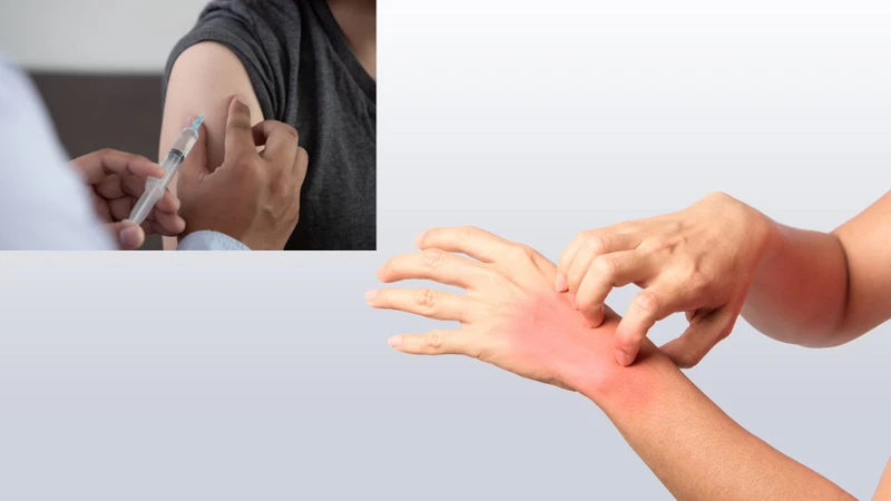 Bị dị ứng có tiêm phòng được không? Lời giải đáp từ phía chuyên gia y tế 1