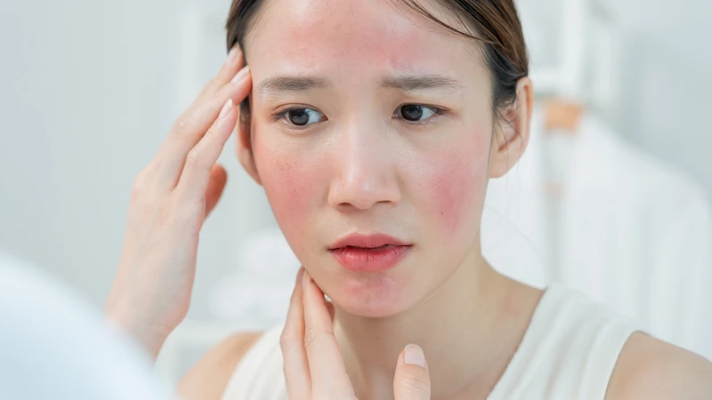 Hiểu đúng để biết khi nào bị dị ứng thức ăn vẫn có thể tắm an toàn