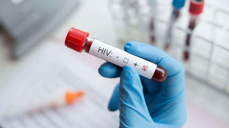 Người nhiễm HIV thường dễ mắc các thể ghẻ nặng