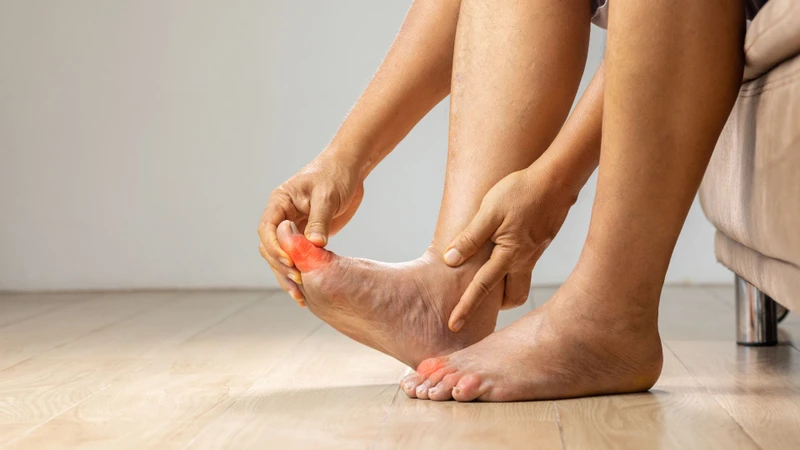 Người bệnh gout thường có cảm giác đau nhói, bỏng rát hoặc như bị kim châm tại khớp