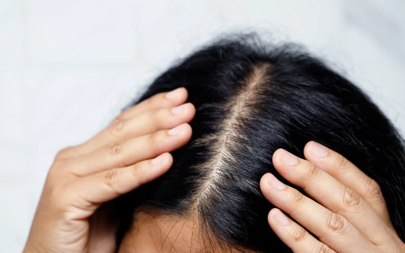 Tránh lạm dụng dầu gội có chất tẩy rửa nhiều dễ ảnh hưởng tới da đầu
