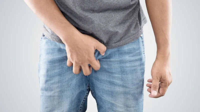 Bị ngứa vùng kín nam giới: Nguyên nhân, mức độ nguy hiểm và cách điều trị hiệu quả 2