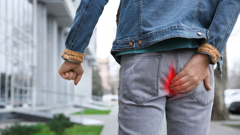 Bị polyp hậu môn có nguy hiểm không​? Điều trị polyp hậu môn như thế nào? 1