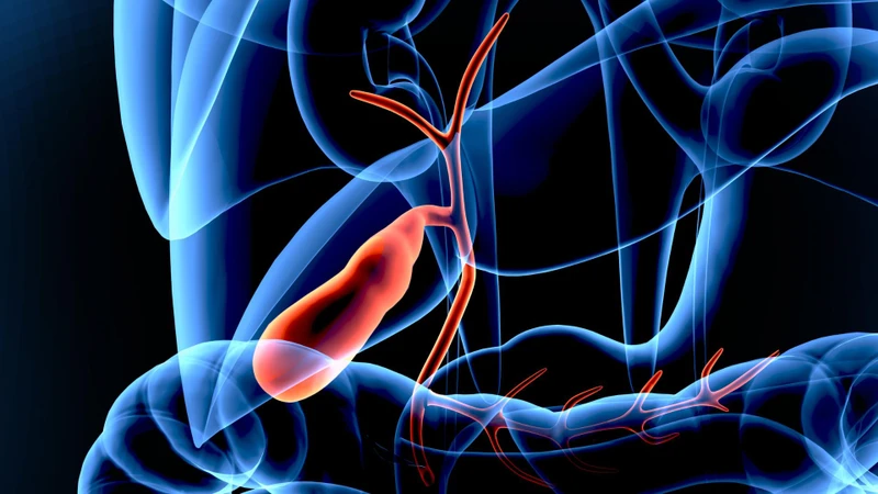 Polyp túi mật thường không tự biến mất, kể cả khi còn nhỏ