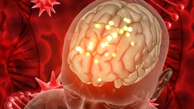 Virus thủy đậu sẽ tồn tại trong dây thần kinh và có thể tái hoạt khi cơ thể mệt mỏi hoặc miễn dịch giảm gây&nbsp;zona thần kinh