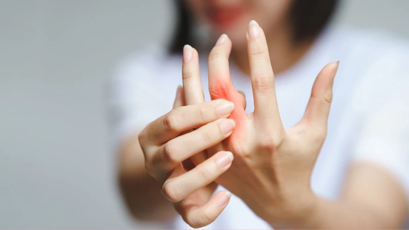 Viêm khớp dạng thấp là nguyên nhân thường gặp gây biến dạng ngón tay