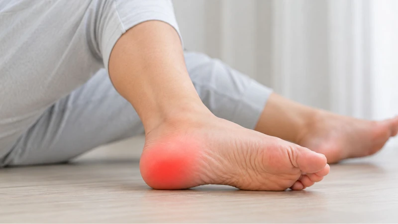 Hội chứng Haglund thường đi kèm đau và tổn thương mô mềm quanh gót