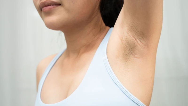 Không nên xem mỡ trăn là phương pháp triệt lông vĩnh viễn