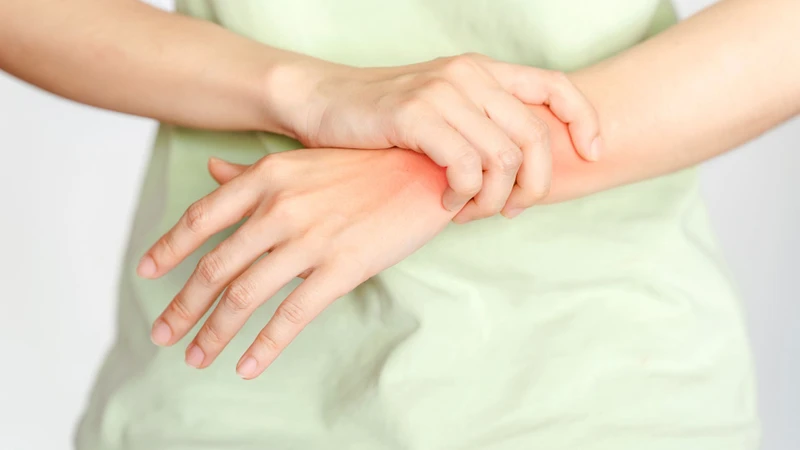 Bong gân cổ tay là tình trạng dây chằng quanh khớp cổ tay bị kéo giãn quá mức