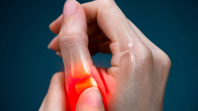 Bong gân ngón tay cái gây đau, sưng và hạn chế vận động