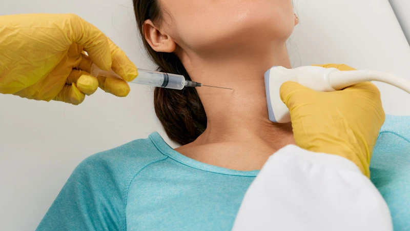 FNA không được thực hiện thường quy cho mọi trường hợp bướu cổ