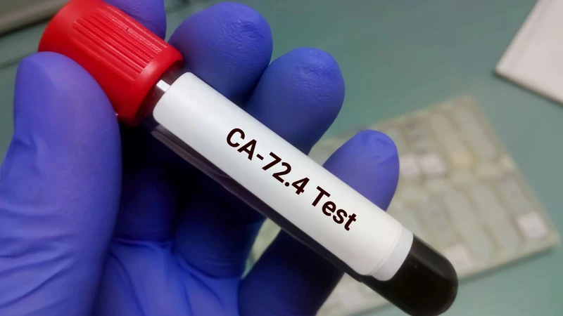 CA 72-4 là một xét nghiệm định lượng nồng độ của glycoprotein có tên gọi TAG-72 (Tumor-Associated Glycoprotein 72) trong huyết thanh