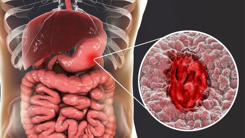 Niêm mạc là gì? Các bệnh lý liên quan mà bạn nên biết 0