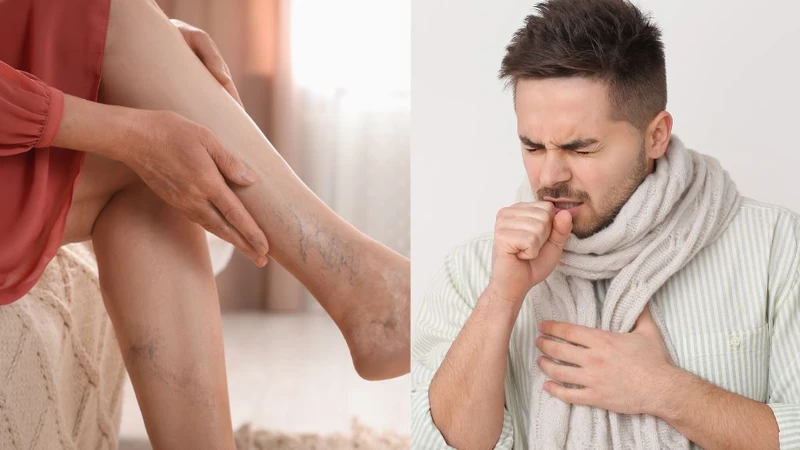 Bệnh lý nền mạn tính có chữa được không và phòng tránh như thế nào? 1