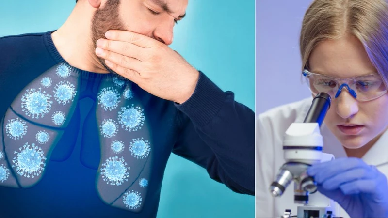 Xét nghiệm cấy đờm và những điều nên biết về xét nghiệm này 1