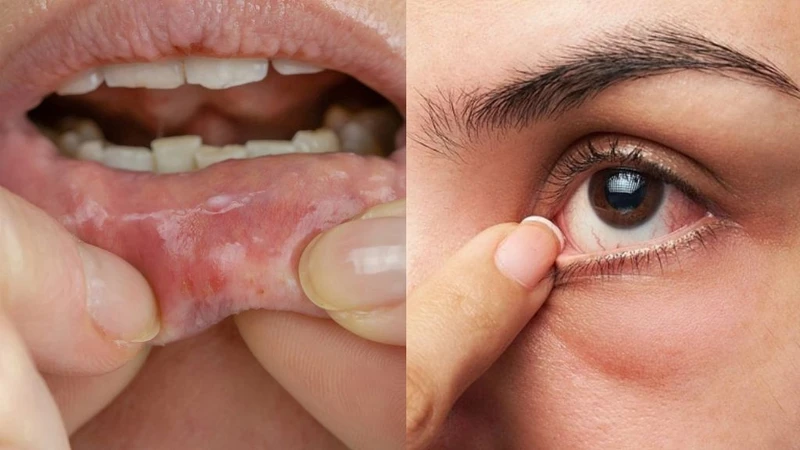 Niêm mạc là gì? Các bệnh lý liên quan mà bạn nên biết 2