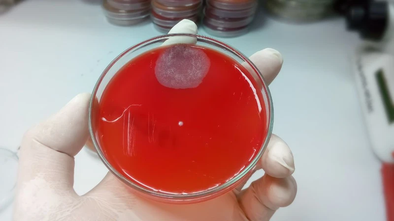 Xét nghiệm cấy đờm và những điều nên biết về xét nghiệm này 3