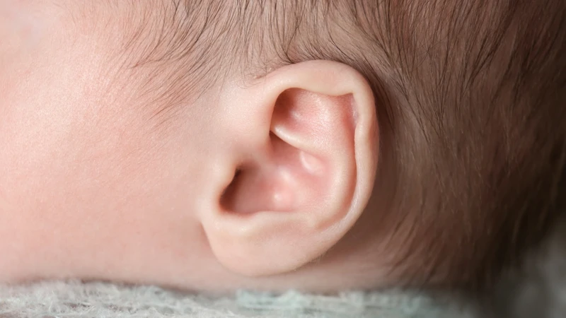 Tai nhỏ được chia thành bốn độ, từ tai nhỏ nhẹ đến không có vành tai ngoài