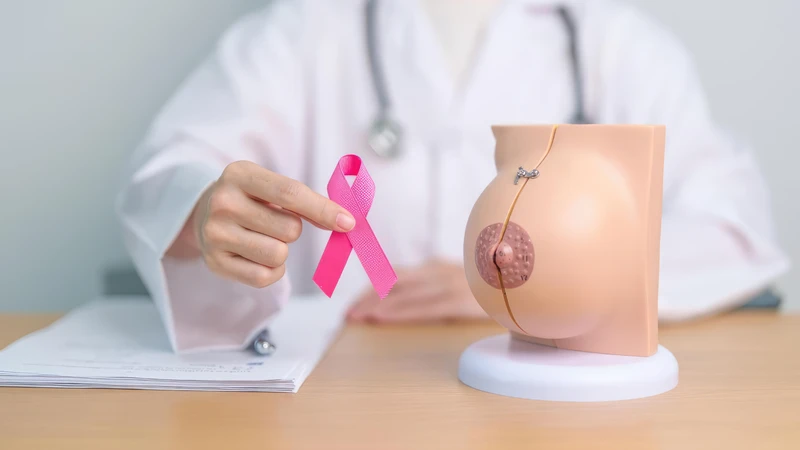 Xác định đúng giai đoạn ung thư vú là bước quan trọng trong quá trình chẩn đoán