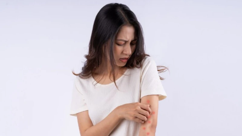 Các loại muỗi nào thường gặp ở Việt Nam? 3
