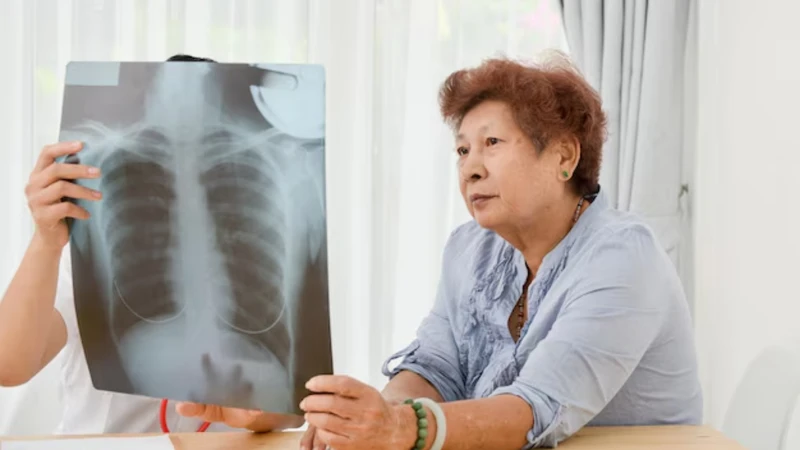 Các phương pháp tầm soát ung thư phổi hiện nay 3