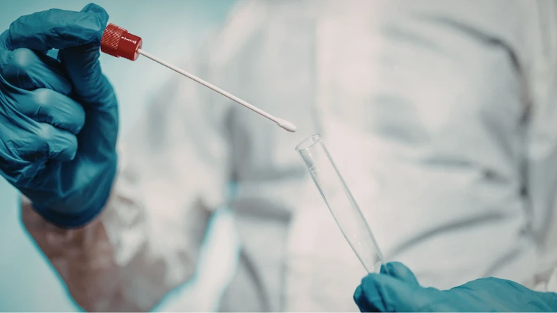 Xét nghiệm Measles PCR được thực hiện bằng cách lấy mẫu dịch hầu họng để phát hiện virus sởi