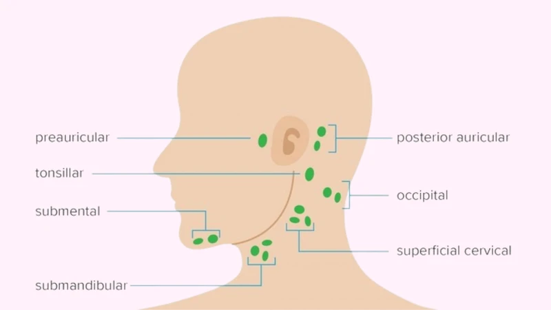 Các vị trí nổi hạch trên cơ thể là vấn đề được nhiều người quan tâm