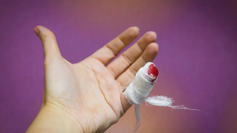 Cách cầm máu khi bị đứt tay​ nhanh chóng và an toàn? 3