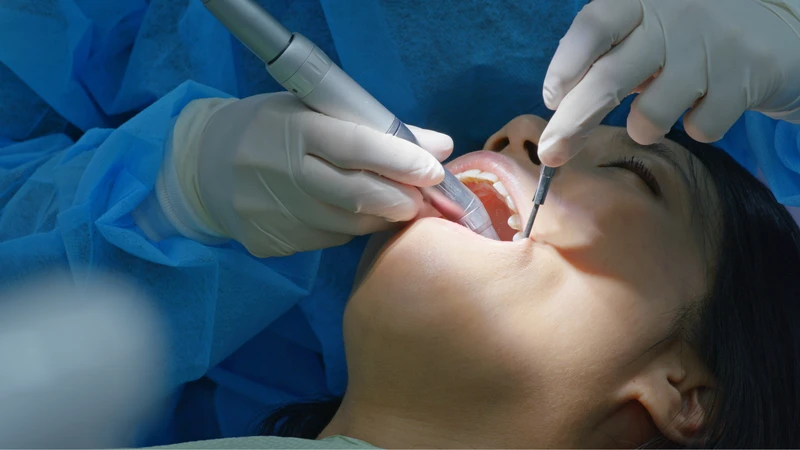 Nếu máu không giảm sau 30 - 60 phút cắn gạc, nên liên hệ nha sĩ để kiểm tra