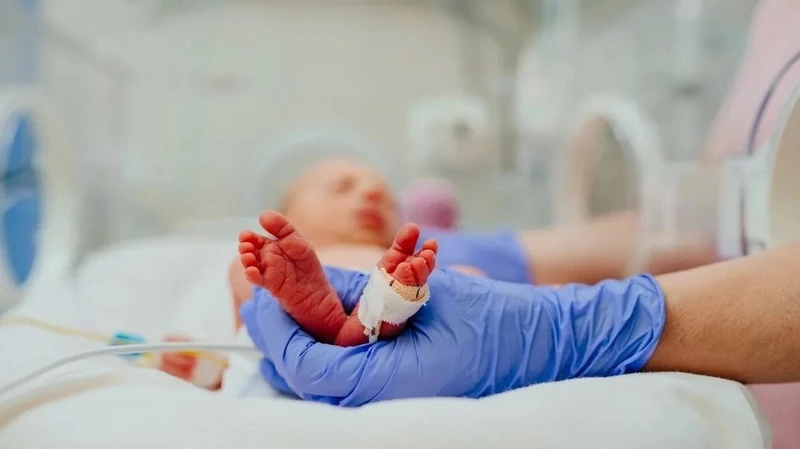Cách chăm sóc trẻ sinh non 32 tuần và nguy cơ sức khỏe 5