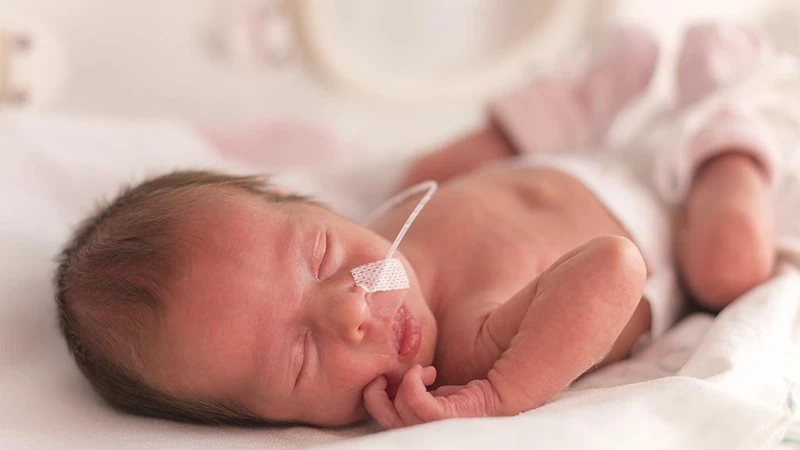 Cách chăm sóc trẻ sinh non 32 tuần và nguy cơ sức khỏe 3