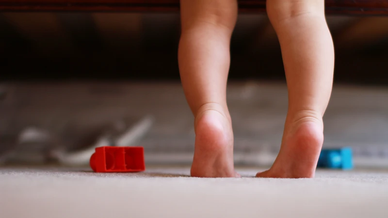 Cách chữa bàn chân bẹt ở trẻ em an toàn và hiệu quả 1