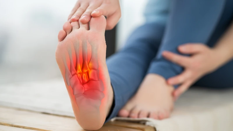 Gai gót chân thường liên quan đến tình trạng viêm cân gan chân kéo dài