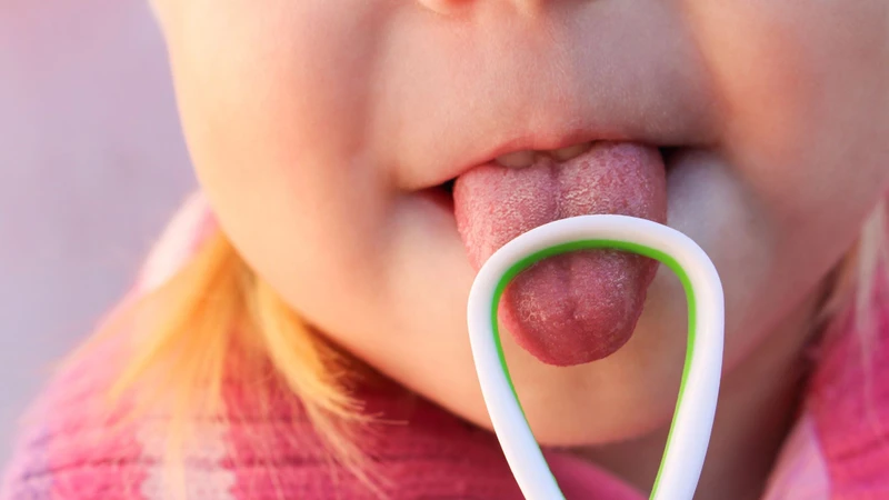 Cách chữa viêm lưỡi bản đồ ở trẻ em an toàn, đơn giản cha mẹ có thể áp dụng 3