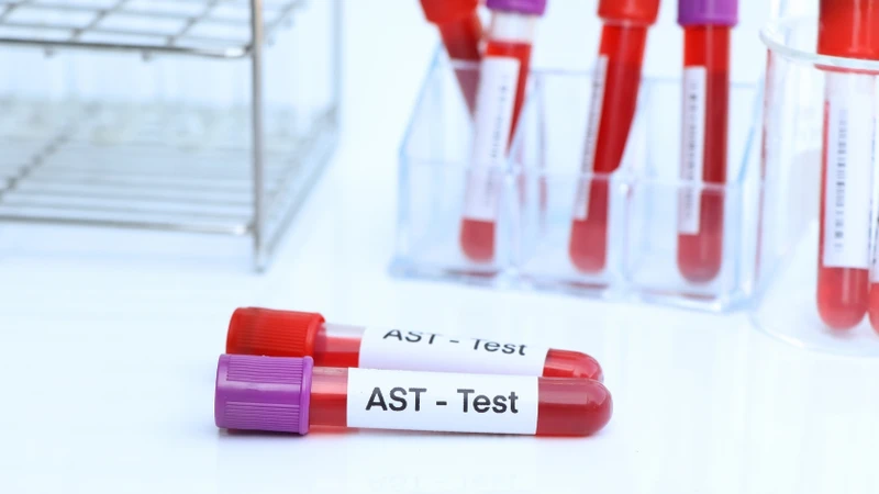 AST tham gia chuyển hóa amino acid trong gan, cơ tim và cơ xương