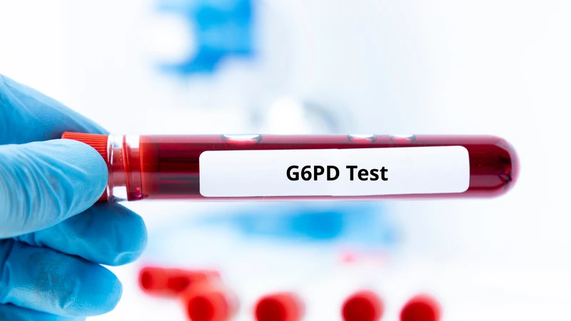 Cách đọc kết quả xét nghiệm G6PD là điều nhiều phụ huynh quan tâm sau khi nhận phiếu xét nghiệm