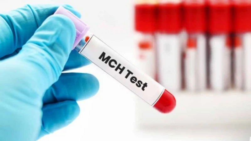 MCHC là nồng độ hemoglobin trung bình trong hồng cầu, giúp đánh giá thiếu máu và cần phân tích cùng MCV, MCH