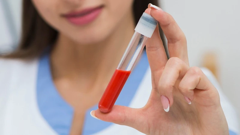 Xét nghiệm sinh hóa máu đo nồng độ và hoạt độ các chất hóa học trong huyết tương