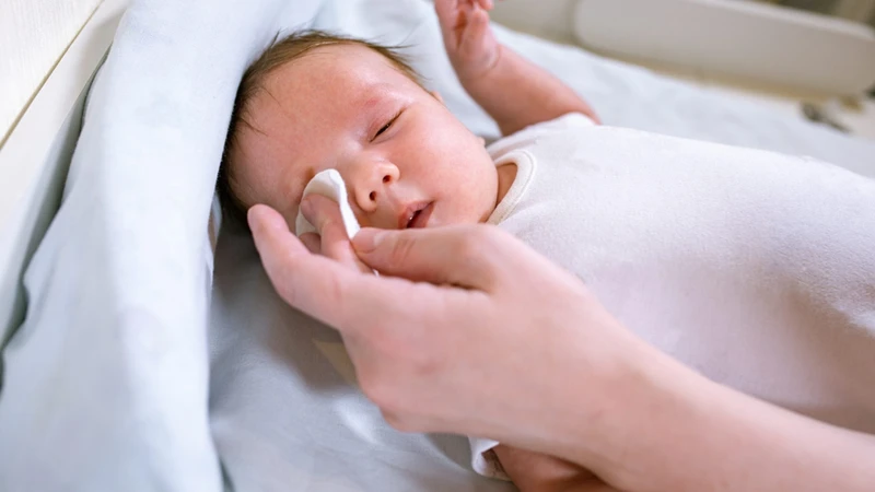 Hướng dẫn cách dùng nước muối sinh lý rửa mắt cho bé