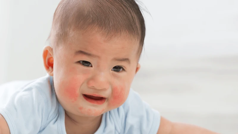cach-giam-dau-khi-tiem-uon-van-cho-tre-5.png